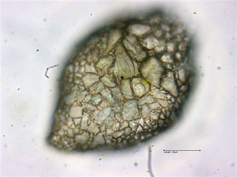  Testate Amoeba -  Odkryj fascynujący mikroswiat jednokomórkowców z pancerzem!